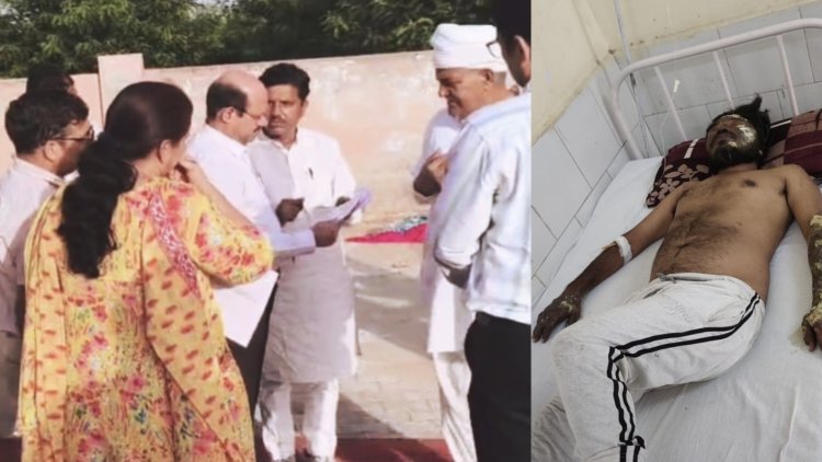 सूरतगढ़ दशहरा हादसा: कुंभकरण के पुतला से फोटोग्राफर झुलसा, नगरपालिका पर गंभीर आरोप