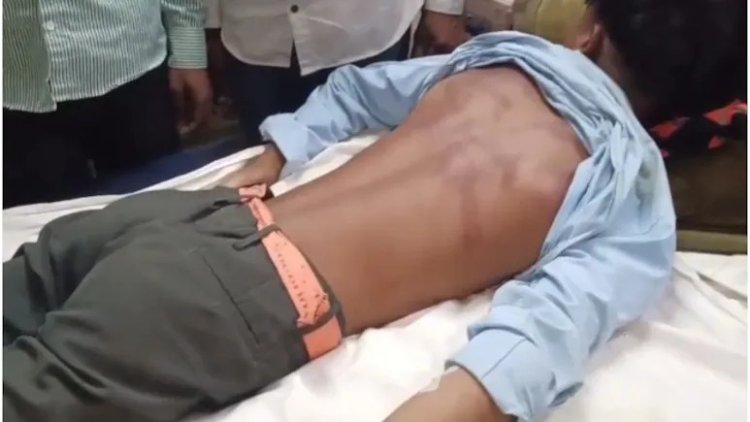  बांसवाड़ा में 12वीं के छात्र का स्कूल से अपहरण, 4 किलोमीटर दूर झाड़ियों में घायल अवस्था में मिला छात्र